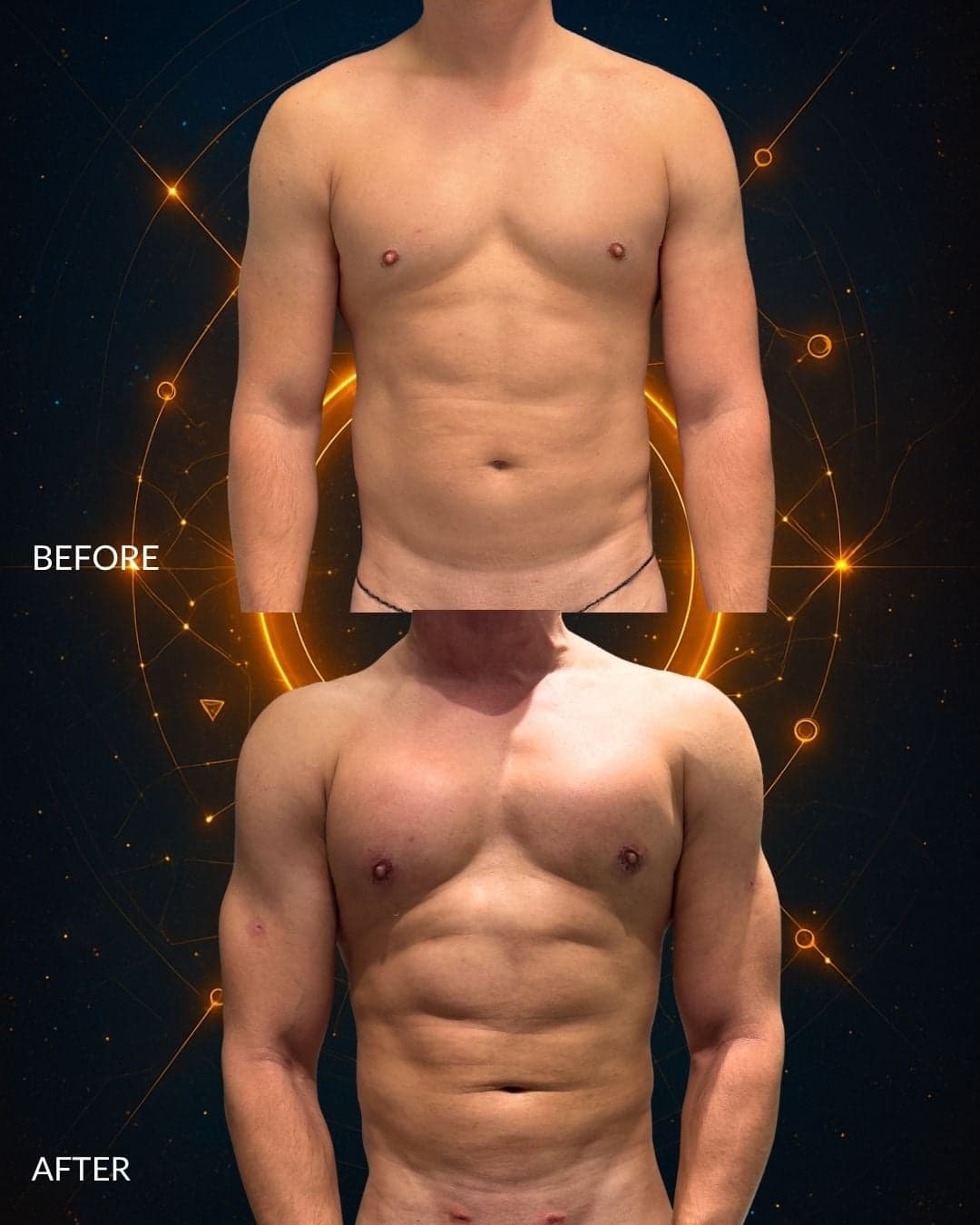 MAXORIS Body Sculpting — before and after